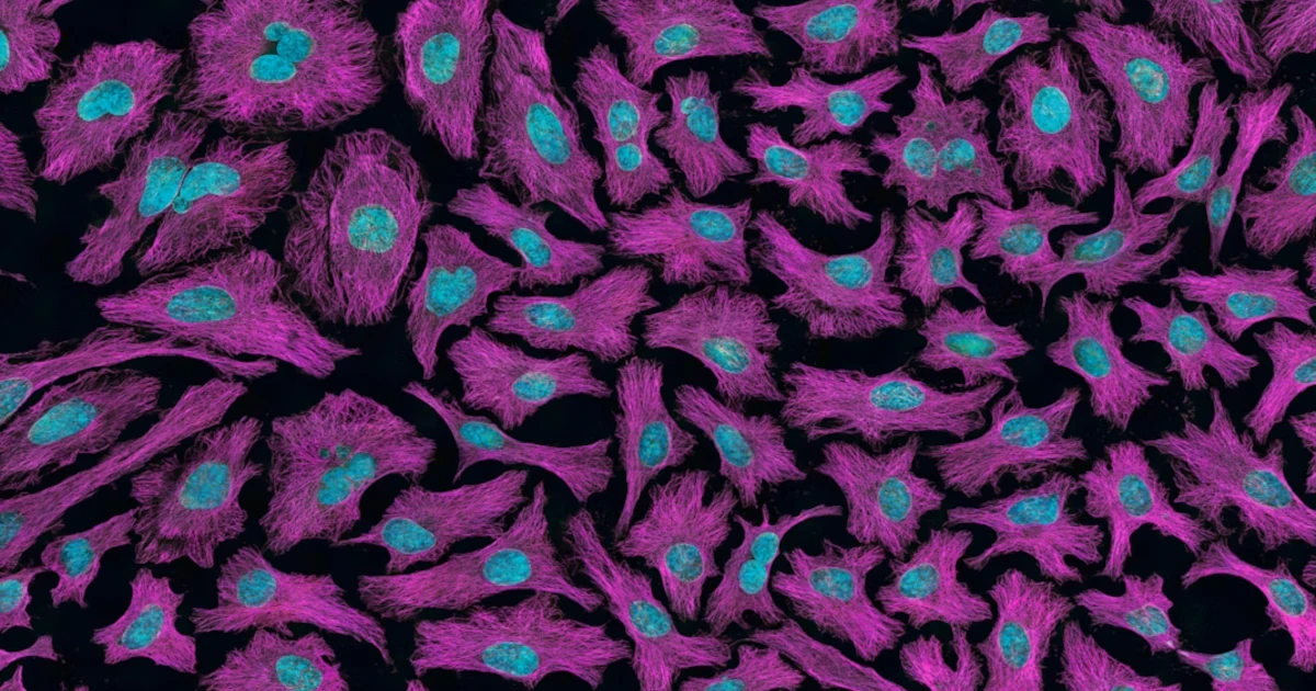Mapa mutácií rakoviny: Vedci prvýkrát presne ukázali, ktoré zmeny v génoch poháňajú nádory
